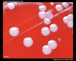 colonies of staph epidermidis on blood agar